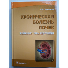 Хроническая болезнь почек. Избранные главы нефрологии. Томилина, Волгина, Бикбов