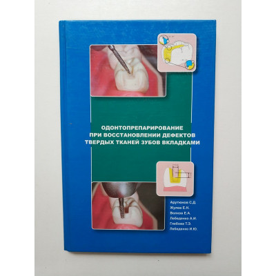 Одонтопрепарирование при восстановлении дефектов твердых тканей зубов вкладками 